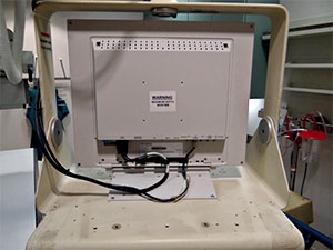 Modalixx G202MG back view of mounting in Picker R/F room ceiling suspension showing the standard desk top mount adapted to the ceiling suspension tray