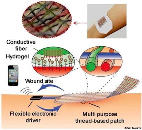 New Smart Bandage Could Independently Treat Wounds